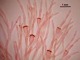 4 – Porzioni apicali del tallo con cellule fertili intercalari provviste di tetrasporocisti
